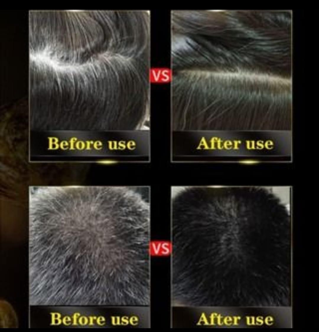 BLOSDREAM Black Hair Shampoo 3 in 1 | Buy 1 Get 1 FREE