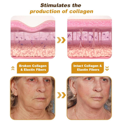 BeeTox™ - Bee Venom Wrinkle Repair Cream | Pack of 2 | Buy 1 Get 1 Free